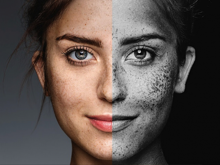 Ánh nắng – Người bạn đồng hành và cũng là thử thách cho làn da